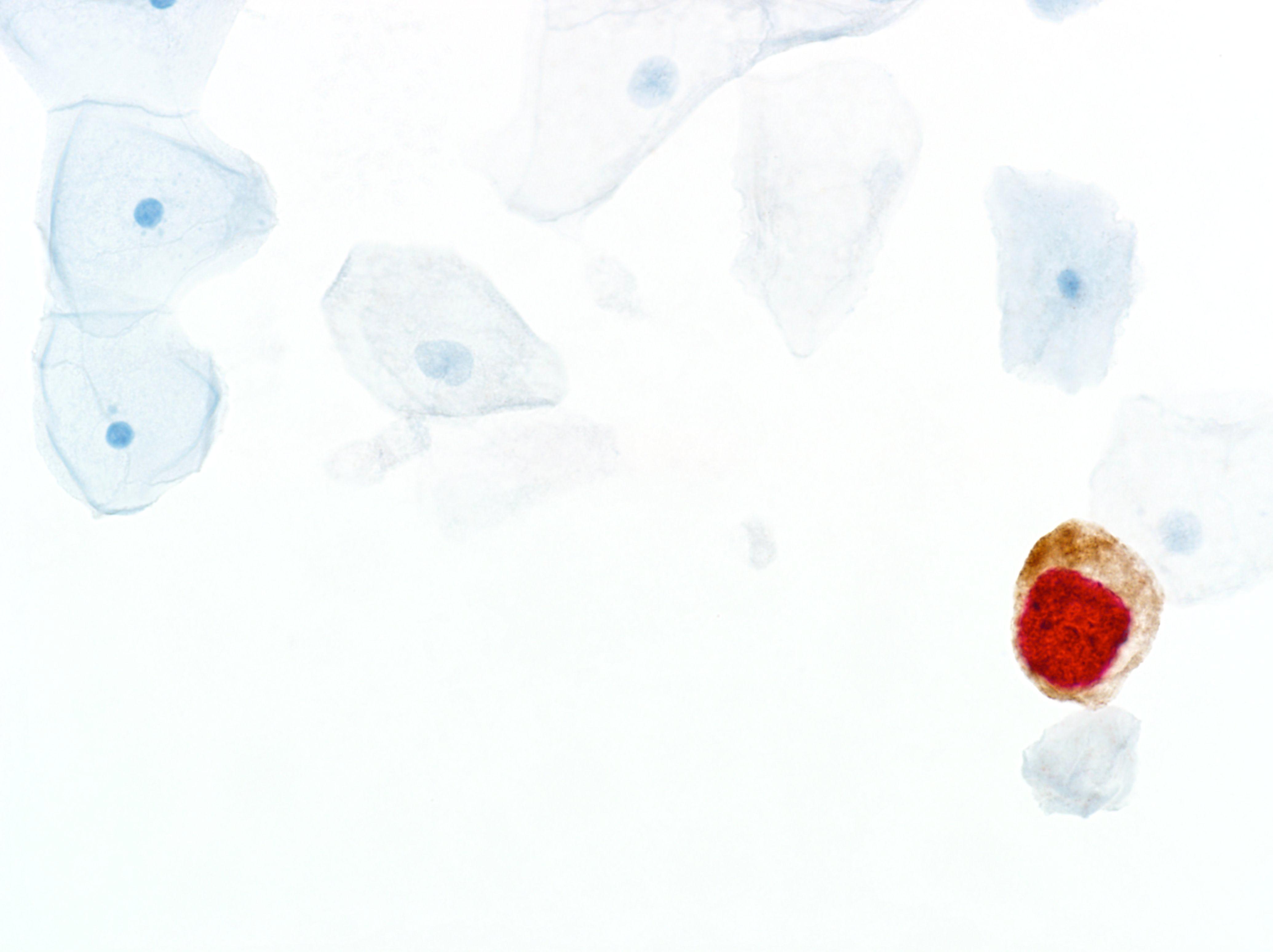 CINtec<sup>®</sup> <i>PLUS</i> Cytology Kit, CE-IVD